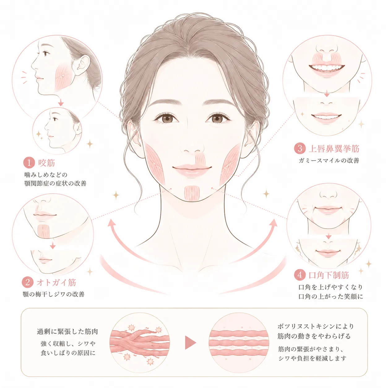 ボツリヌス治療