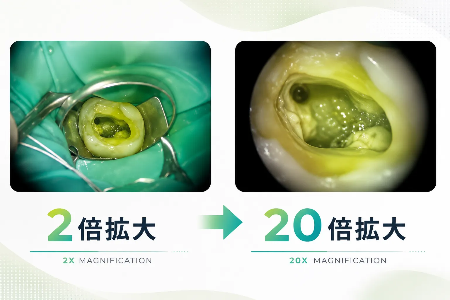 20倍